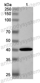 Anti-Human GTSE1 Polyclonal Antibody