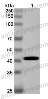 Anti-Human SDCCAG8 Polyclonal Antibody