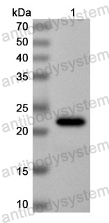 Anti-Human IRGM Polyclonal Antibody