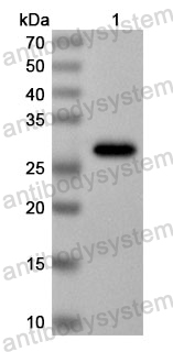 Anti-Human TARS3 Polyclonal Antibody