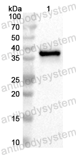 Anti-Human HEPACAM2 Polyclonal Antibody