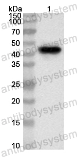 Anti-Human KDM4E Polyclonal Antibody