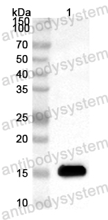 Anti-Human KIF12 Polyclonal Antibody