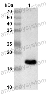 Anti-Human ZBTB42 Polyclonal Antibody
