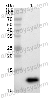 Anti-Human Lambda light chain Polyclonal Antibody