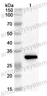 Anti-Human ECRG4 Polyclonal Antibody