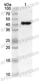 Anti-Human FANCM Polyclonal Antibody
