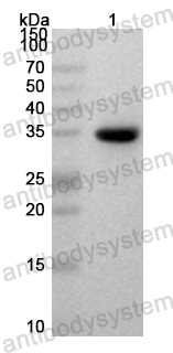 Anti-Human USP30 Polyclonal Antibody