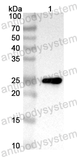 Anti-Human SGPP2 Polyclonal Antibody