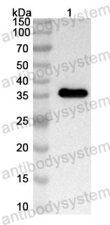 Anti-Human USP47 Polyclonal Antibody