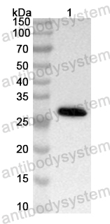 Anti-Human GPBAR1 Polyclonal Antibody