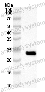 Anti-Human PRDM9 Polyclonal Antibody