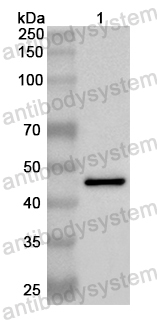 Anti-Human SUGCT Polyclonal Antibody