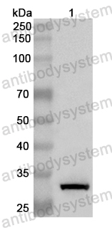 Anti-Human IKZF3 Polyclonal Antibody