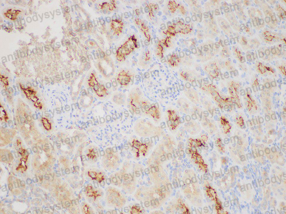 Immunohistochemical for Anti-Mouse ANGPT2/Ang2 Polyclonal Antibody ?>