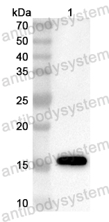 Anti-Mouse SOAT2 Polyclonal Antibody