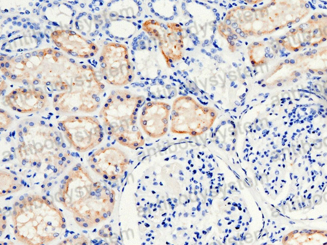 Immunohistochemical for Anti-Mouse RBP4 Polyclonal Antibody ?>