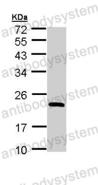 Western Blot for Anti-Mouse RBP4 Polyclonal Antibody ?>