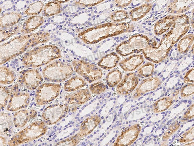 Immunohistochemical for Anti-Mouse CTSB Polyclonal Antibody ?>