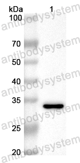 Anti-Mouse CD126/IL6R/IL-6RA Polyclonal Antibody