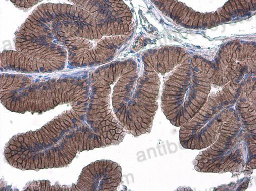 Immunohistochemical for Anti-Mouse CD324/CDH1 Polyclonal Antibody ?>