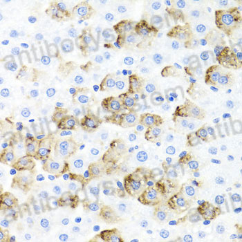 Immunohistochemical for Anti-Mouse CD142/F3/TF Polyclonal Antibody ?>