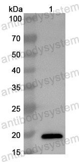 Anti-Mouse CD62E/SELE Polyclonal Antibody