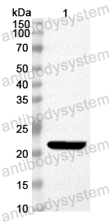 Anti-Mouse ALOX12 Polyclonal Antibody