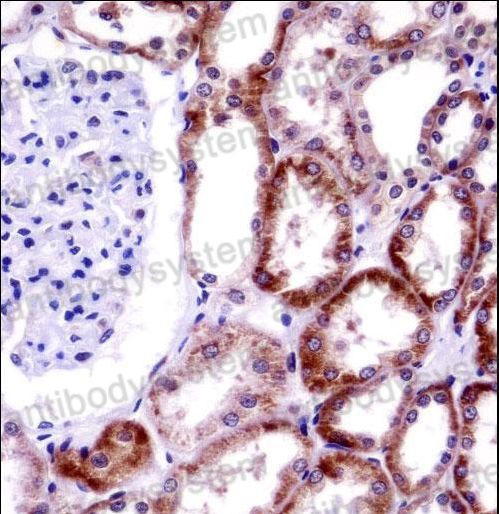 Immunohistochemical for Anti-Mouse CD70 Polyclonal Antibody ?>