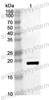 Anti-Mouse ATP7B Polyclonal Antibody