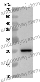Anti-Mouse ACVRL1 Polyclonal Antibody