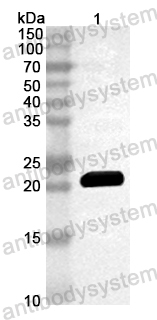 Anti-Mouse RANBP2 Polyclonal Antibody