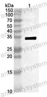 Anti-Mouse PPT1 Polyclonal Antibody