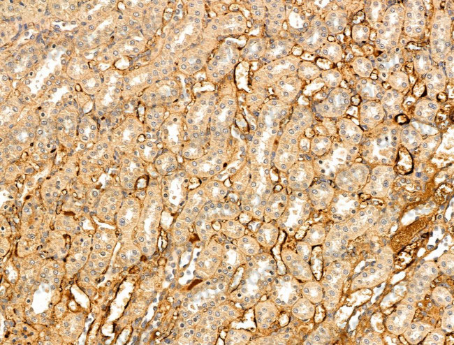 Immunohistochemical for Anti-Mouse VLDLR Polyclonal Antibody ?>
