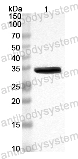 Anti-Mouse UPP1 Polyclonal Antibody