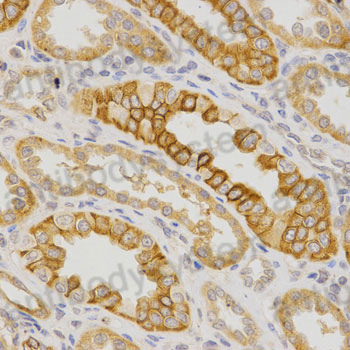 Immunohistochemical for Anti-Mouse IL23R Polyclonal Antibody ?>