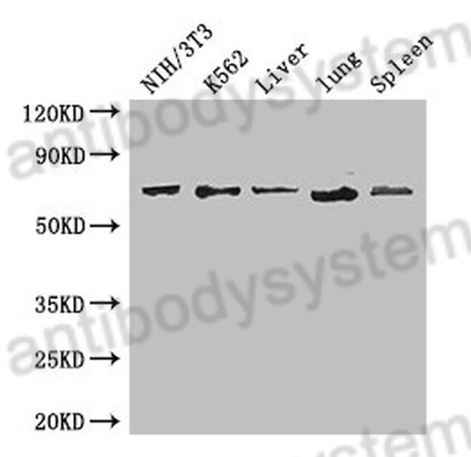 Western Blot for Anti-Mouse IL23R Polyclonal Antibody ?>