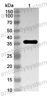 Anti-Mouse FPN1/SLC40A1/Ferroportin Polyclonal Antibody