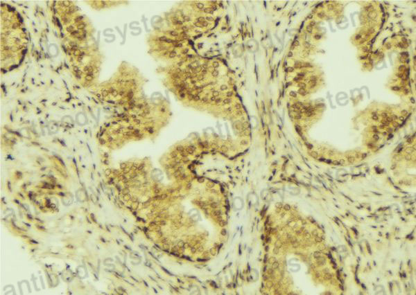 Immunohistochemical for Anti-Mouse CCL28/MEC Polyclonal Antibody ?>