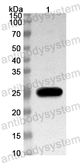 Anti-Mouse TREX1 Polyclonal Antibody