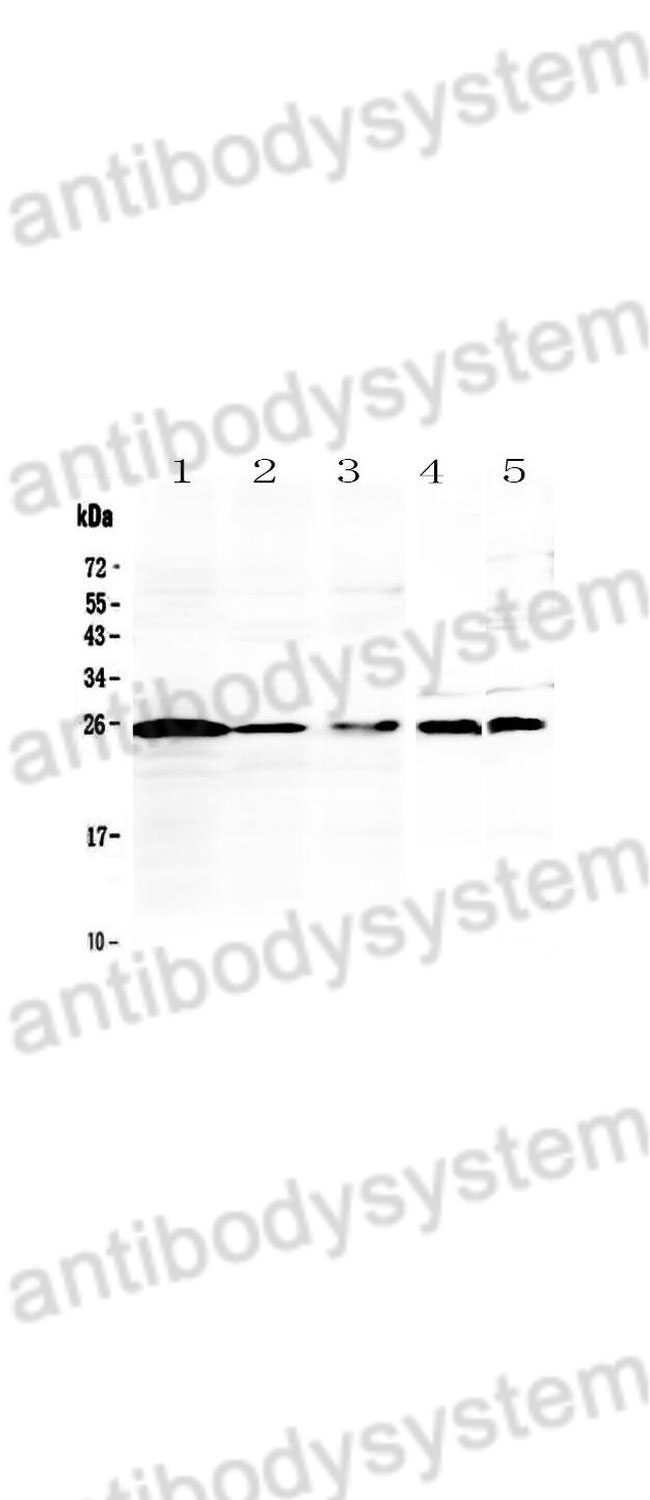 Western Blot for Anti-Mouse IL36A/IL-1F6 Polyclonal Antibody ?>