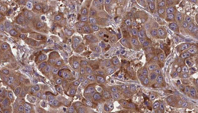 Immunohistochemical for Anti-Mouse TNFSF18 Polyclonal Antibody ?>