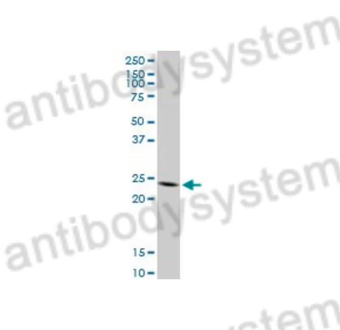 Western Blot for Anti-Mouse TNFSF18 Polyclonal Antibody ?>