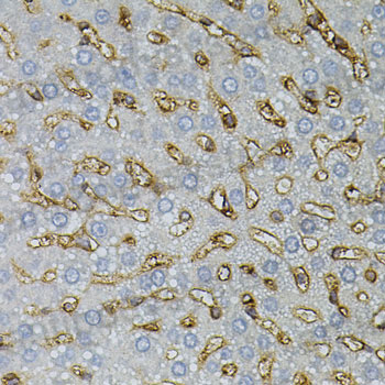 Immunohistochemical for Anti-Mouse ASAH2 Polyclonal Antibody ?>