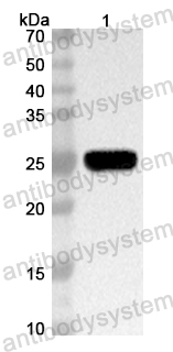 Anti-Mouse ROBO2 Polyclonal Antibody
