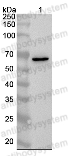 Anti-Liraglutide Polyclonal Antibody