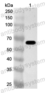 Anti-RABV NP/Nucleoprotein Polyclonal Antibody