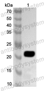 Anti-HAdV-5 E1B-55K Polyclonal Antibody