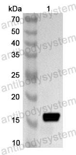 Anti-HAdV-41 E1B-19K Polyclonal Antibody