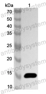 Anti-HIV-2 env/Env polyprotein/gp36 Polyclonal Antibody